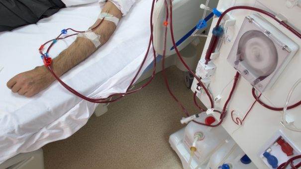 kidney dialysis
